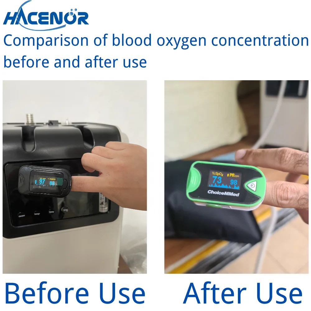 HACENOR Hot Sale 100L Hypoxic Generator Bike Races Use Hypoxic Training Use Simulated 6000 Meters High Altitude Generator