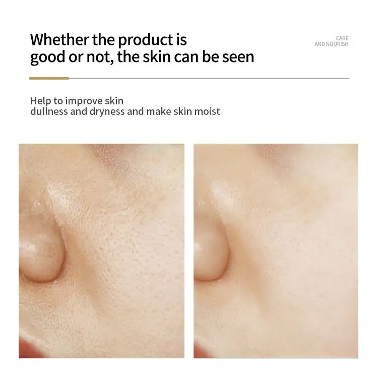 New OEM RAMZER private label nicotinamide natural whitening anti freckle wrinkle skin care moisturizing essential oil face serum