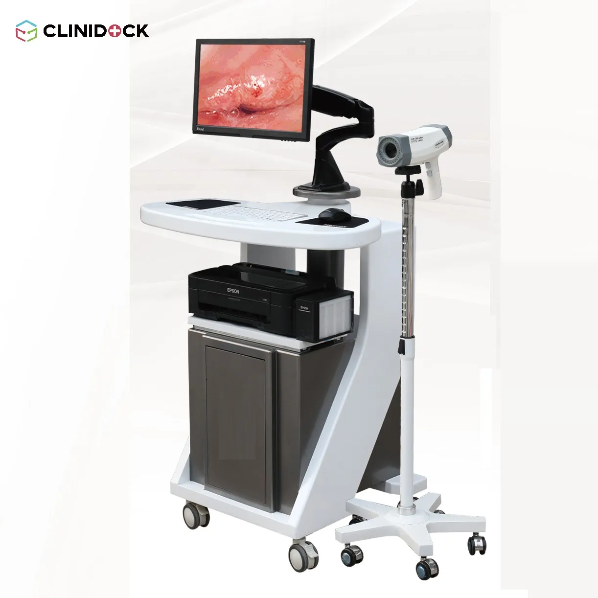 High end Portable Digital Electronic Colposcope, video colposcope for vagina CD-GJ-A8000A