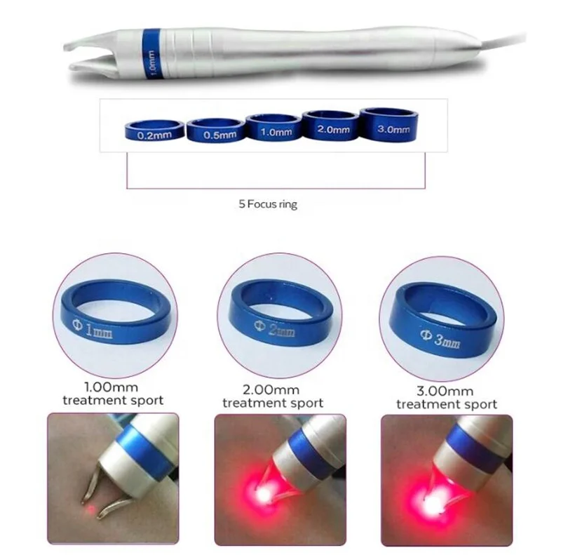 Red Blood Vessels 980nm Spider Veins Removal Diode Laser 980 nm Varicose Veins Laser Treatment Machine