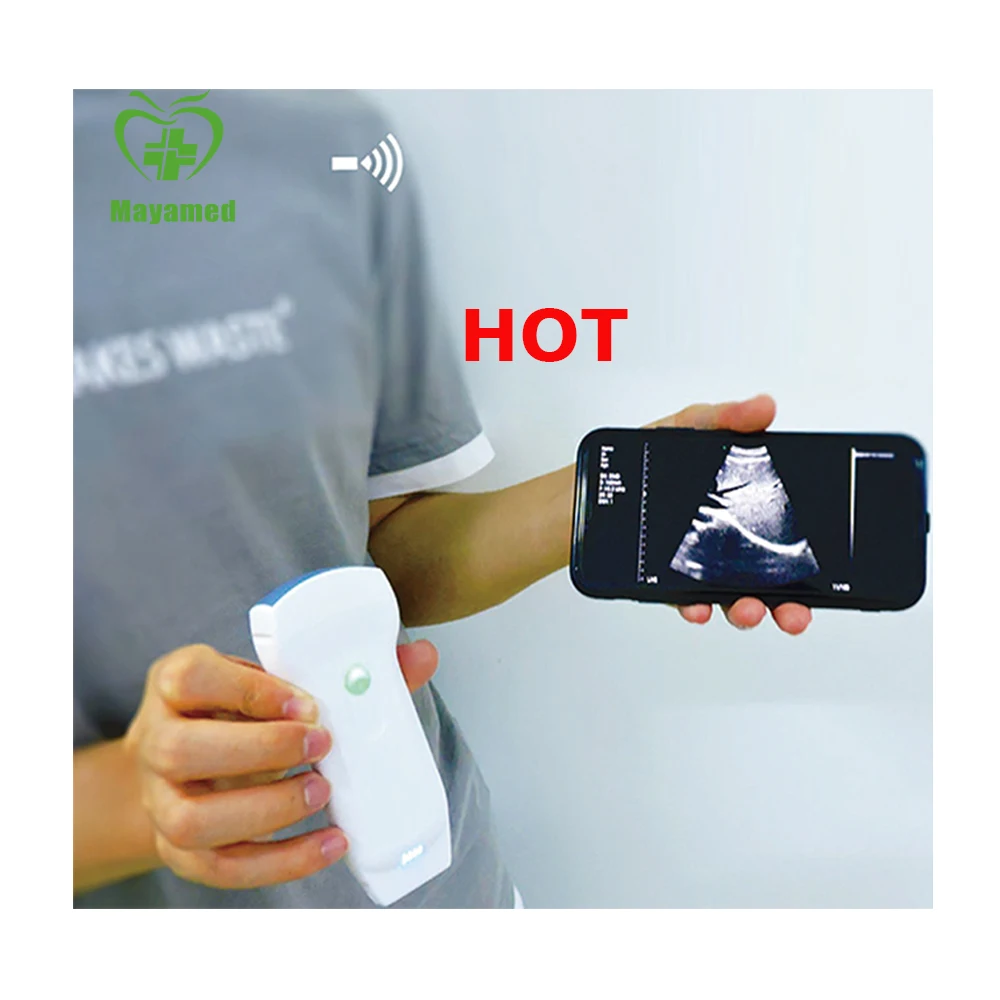 ultrasound scan machine with all the probes portable ultrasound with vascular and echo probe