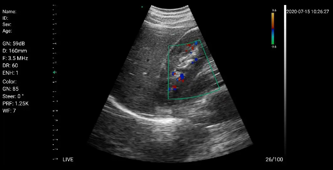 
2020 Wifi & USB handheld 3 in 1 ultrasound probe wireless price C10RL 
