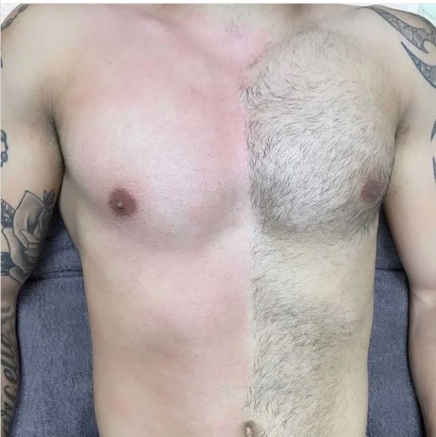 The Latest Technology Painless OPT+IPL Freezing Point 8 Filters Photonic Rejuvenation Pore Contraction Cooling