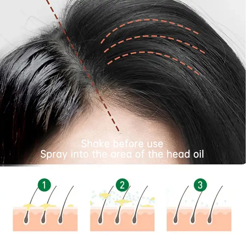 cosmetics manufacturer 150ml oil control dry shampoo spray custom powder cleaning odm dry hair spray oem plant supplier factory