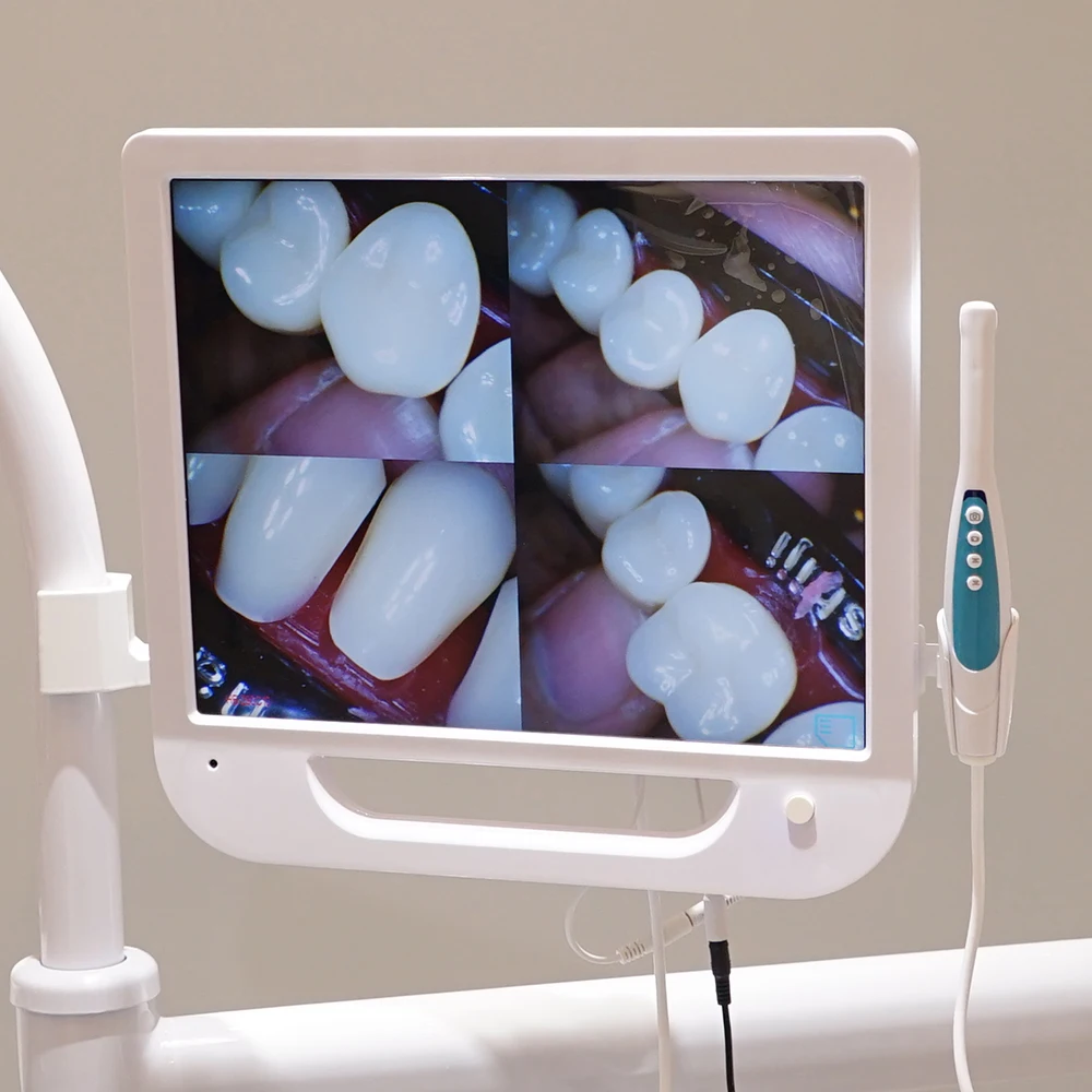 AliGan Dental equipment intra oral endoscope with 1280 x 1024 pixels 17-inch display 6 LED light beads 1/4 CMOS Image Sensor