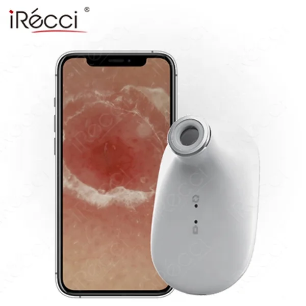 iRecci facial skin pigment scanner analysis device digital face skin dsiagnosis portable handheld skin scanner analyzer for beau