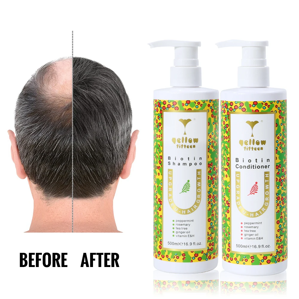 Private Label hair loss treatments shampoo for baldness hair growth professional hair loss shampoo
