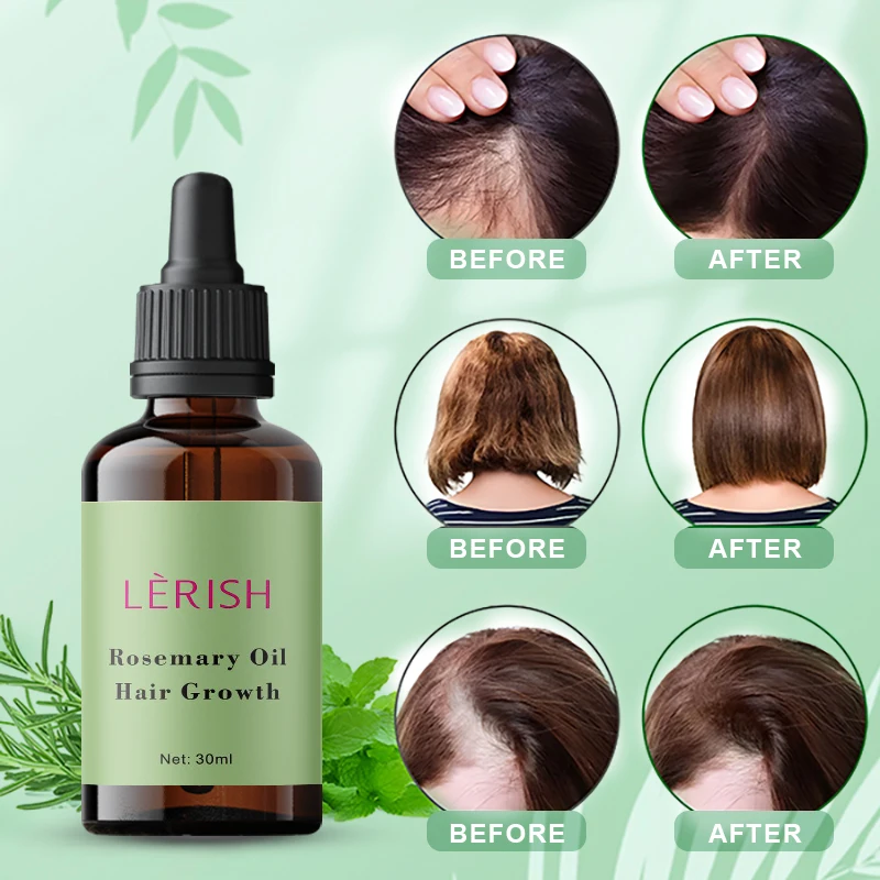 InStock Chebe Oil Natural Organic Rosemary Essential Oil Women Black Hair Care Products Rosemary Oil Chebe Hair Growth
