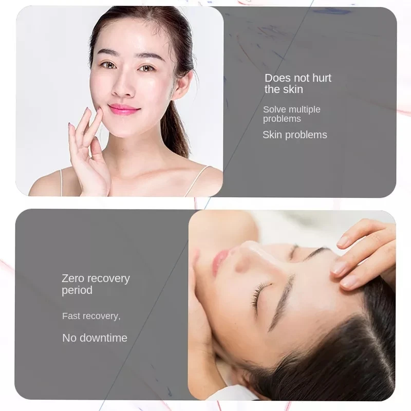 Remove pigment black technology light-sensing non-invasive laser eyebrow washing machine tattoo machine small picosecond