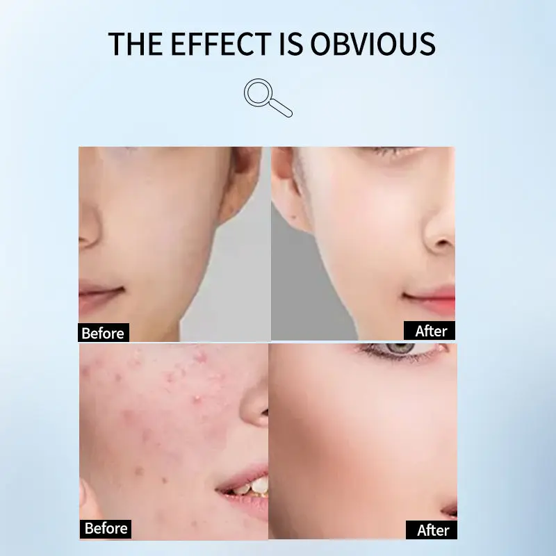 Частной марки Oem безмасляный Отбеливающее увлажняющее очищающее средство для лица против акне органические аминокислоты умывания всех типов