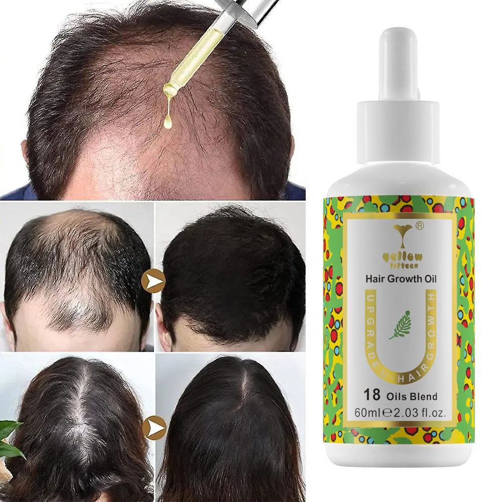OEM Batana oil Oil for Hair Care Products Custom Dry Damage Hair Loss Treatment Biotin Growth Oils