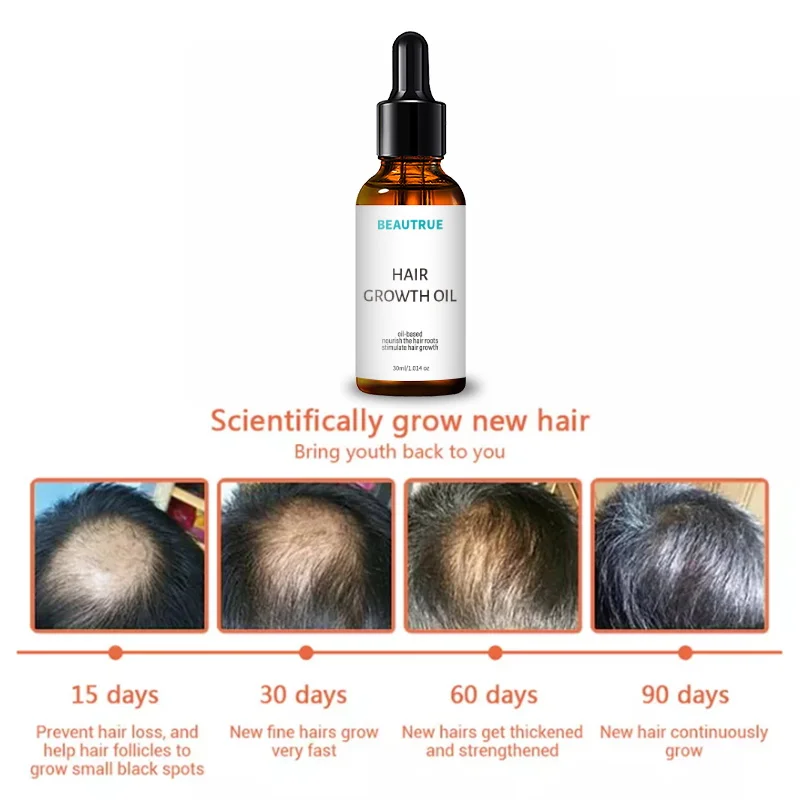 Фирменное органическое 100% масло розмарина для ухода за волосами, масло для роста волос для черных женщин, быстрое масло для роста волос 30 мл