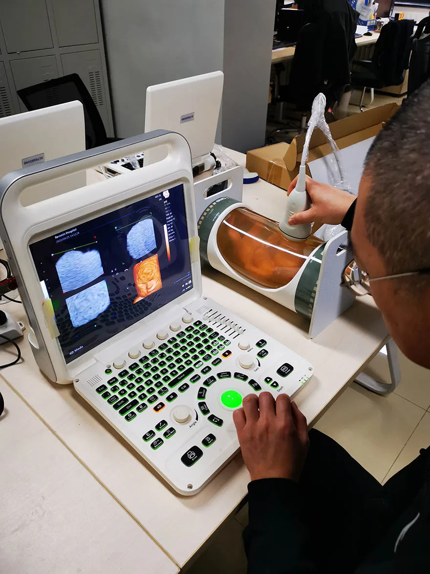 Portable Full-Digital Ultrasound Machine with Electric Power Source Medical Plastic Portable Ultrasound Scan