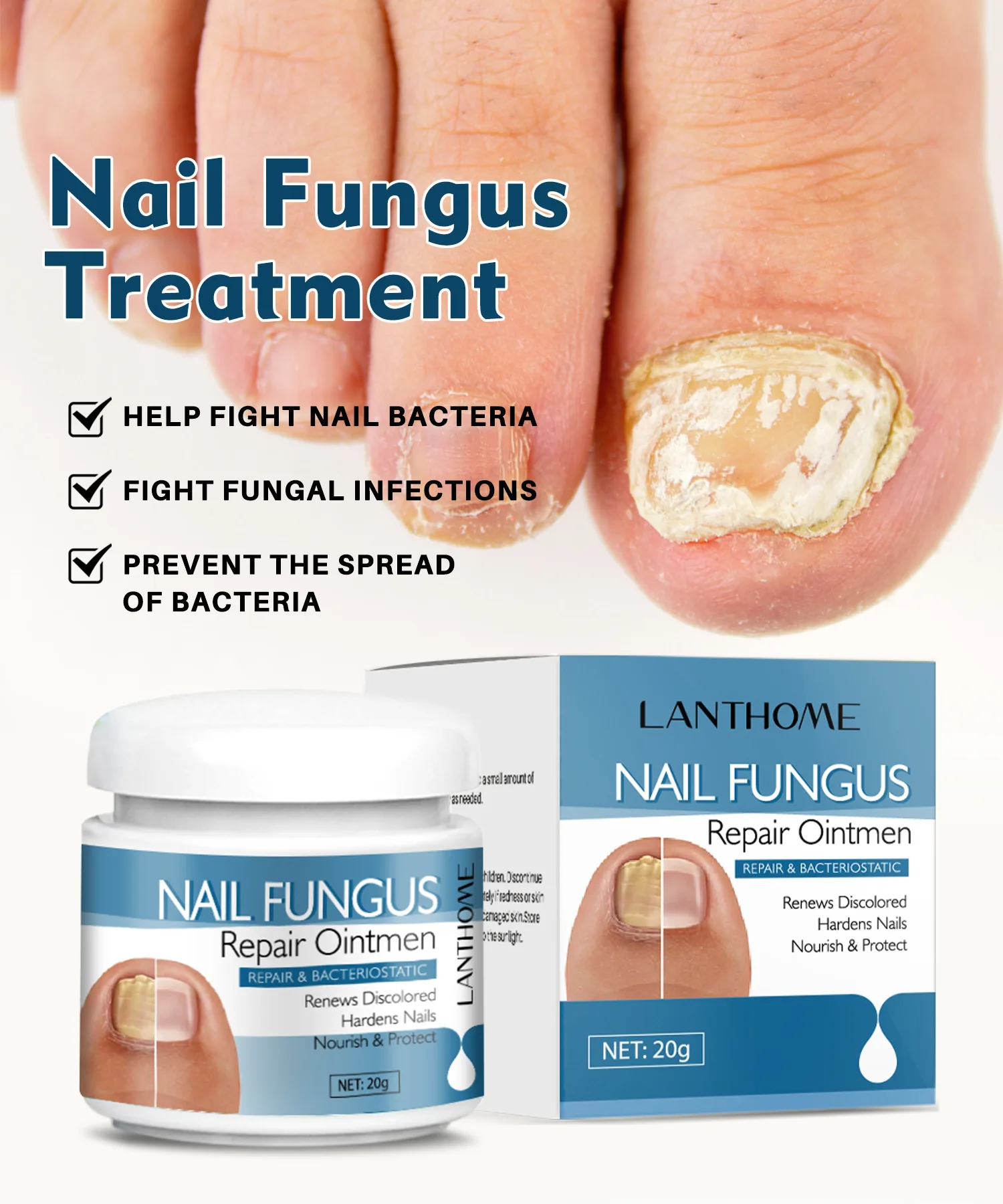 OEM Nail Onychomycosis Fungal Treatment Foot Cream Fungus Removal Cream Paronychia Anti Infection Nails Fungus Repair Ointment