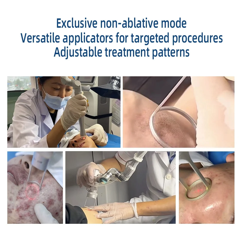 Fractional Laser Vagina Tightening Acne Scar Treatment Co2 Fractional Laser Beauty Device Vaginal Rejuvenation Laser Machine