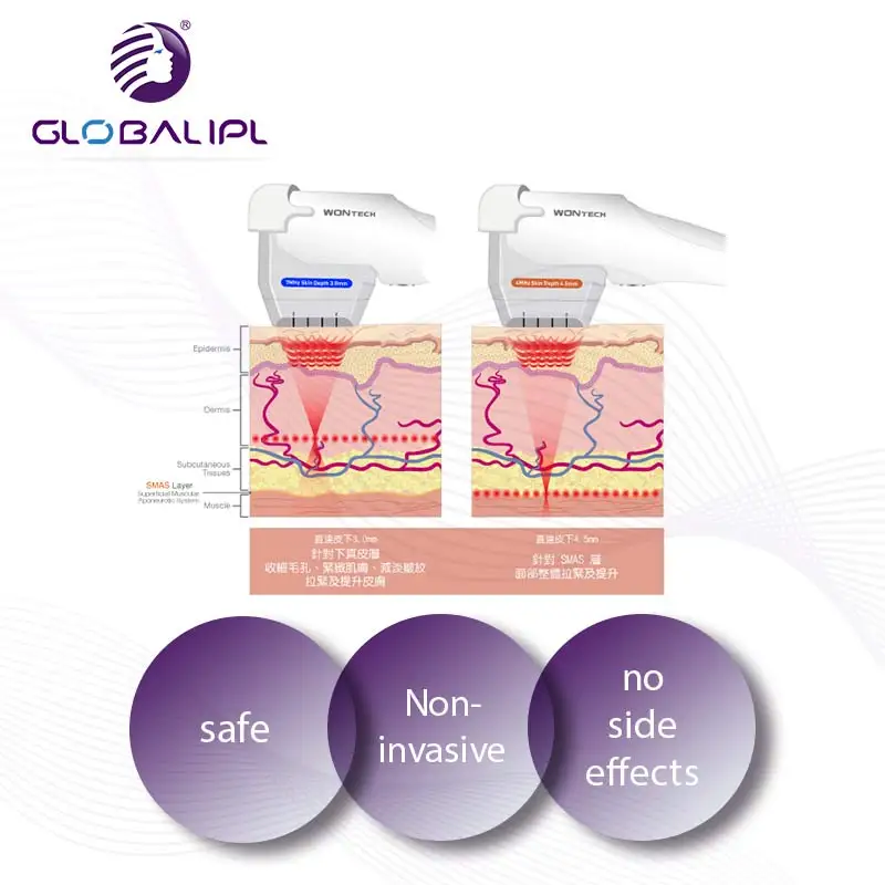 Hifu аппарат для лифтинга лица/Hifu вагинальное подтягивание для салона красоты