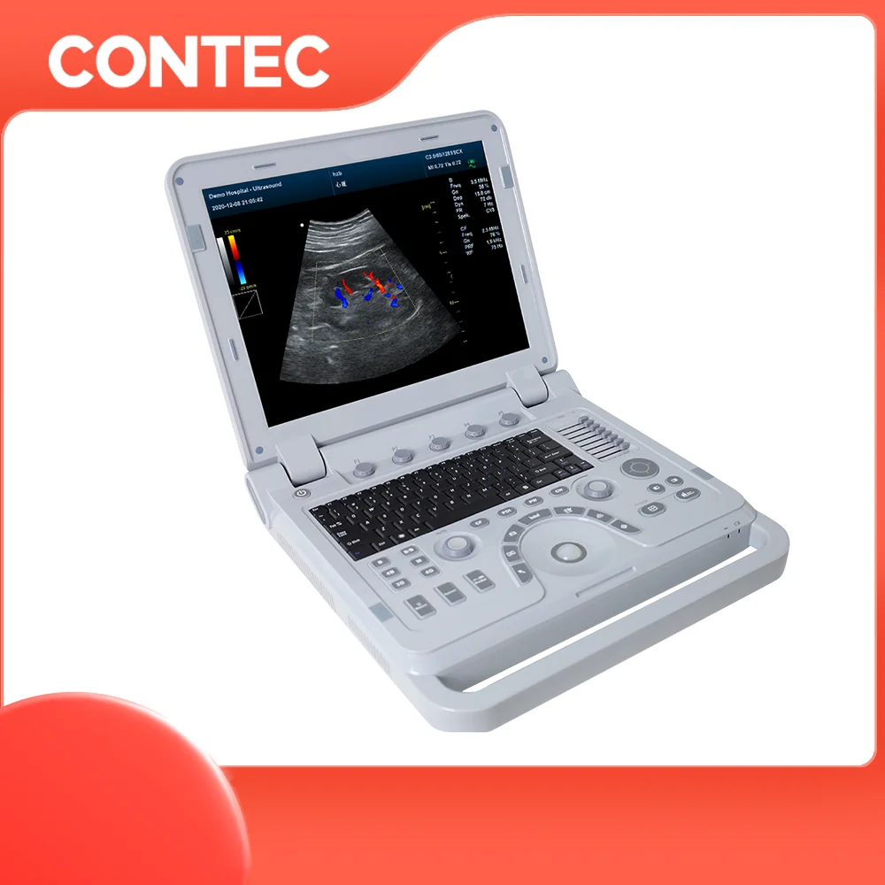 CONTEC CMS1700B Акушерская Урология живота кардиопедическая гинекология периферическая сосудистая диагностика Цветной Допплер