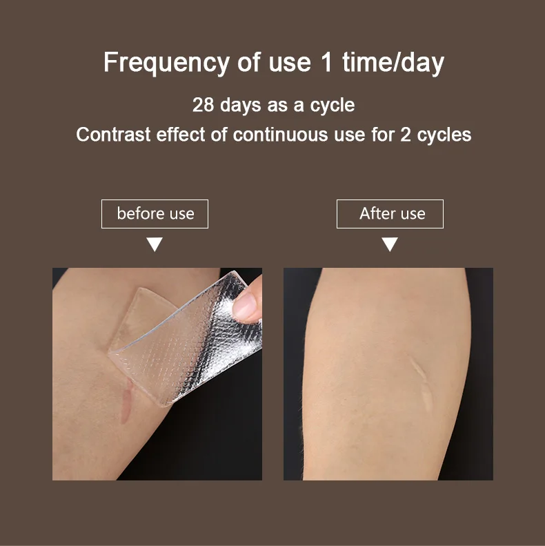 OEM Reusable Acne Tape Therapy Sheet Skin Repair Sheet Silicone Scar Removal Silica Gel Patch