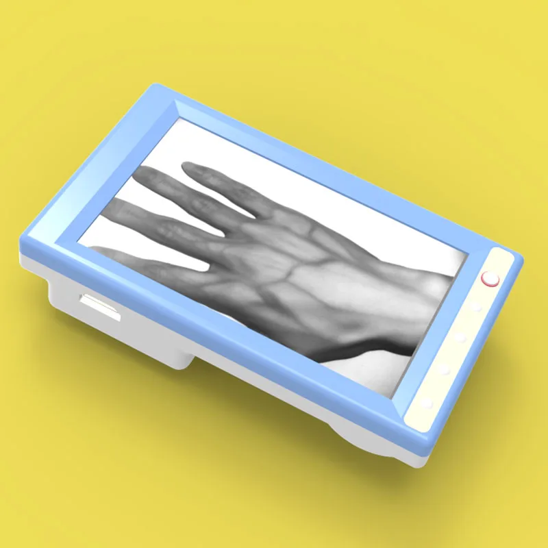 
Hospitals Medical Device Displaying Vein On Patients Vein Finder 