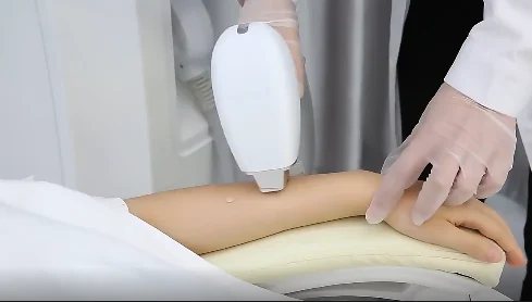 1064nm 1200w big spot size drop shipping laser hair removal machine