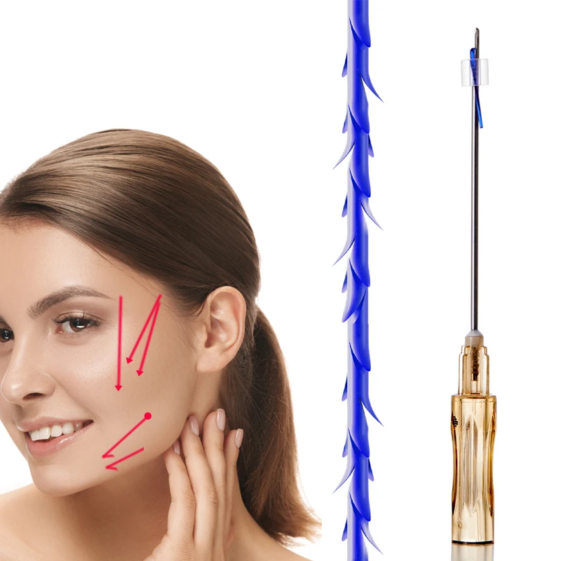 best face lift anti aging absorbable 19g 100mm barb 6d cog pdo thread