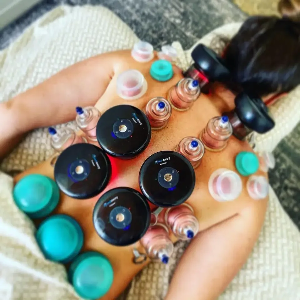 Amazon Hot Sale Vacuum Cupping Hijama Cups Smart Cupping Therapy Massager Cupping Therapy Set