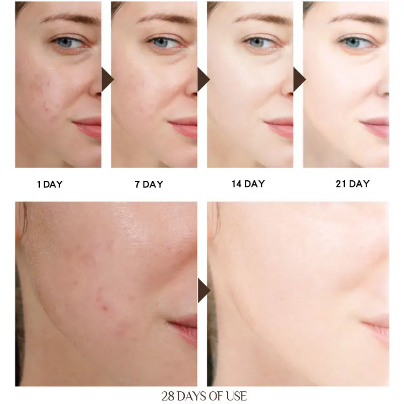 Private Label 100% Pure Collagen Anti-Aging Wrinkle Remover Whitening Elastin Face Cream