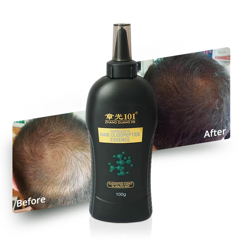High Quality Oligopeptide Hair Treatment Natural Hair Growth Oil