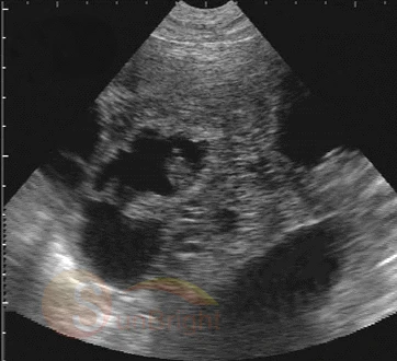 Portable Laptop vet ultrasound scanner equipment For Pet Animal Full Digital Cheapest Laptop veterinary ultrasound