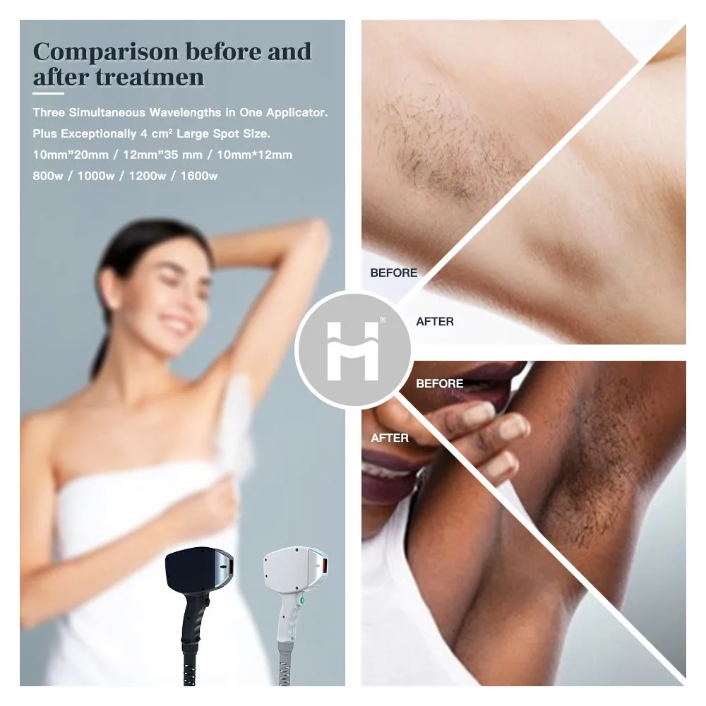 Best price med DILAS laser array diode 808nm/ dioden laser 808/ epil laser diodo 808 prezzo with TUV medical CE0197