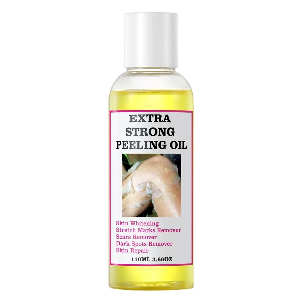 Custom Logo Private Label Body Care Dark knuckle Scars Extra Strong Peeling Oil Dark Spot Remover Whitening Yellow Peeling Oil