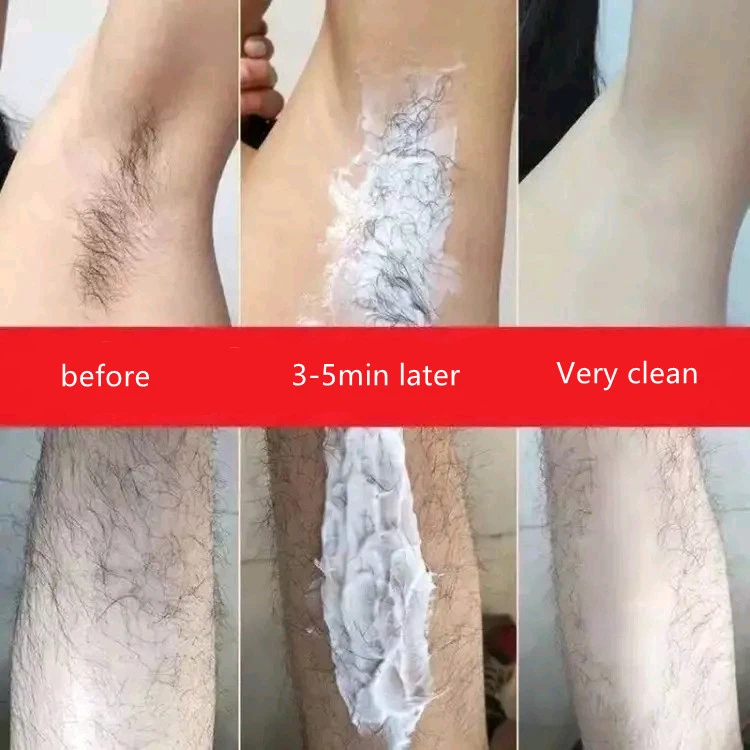 body Hair removal moisturizer