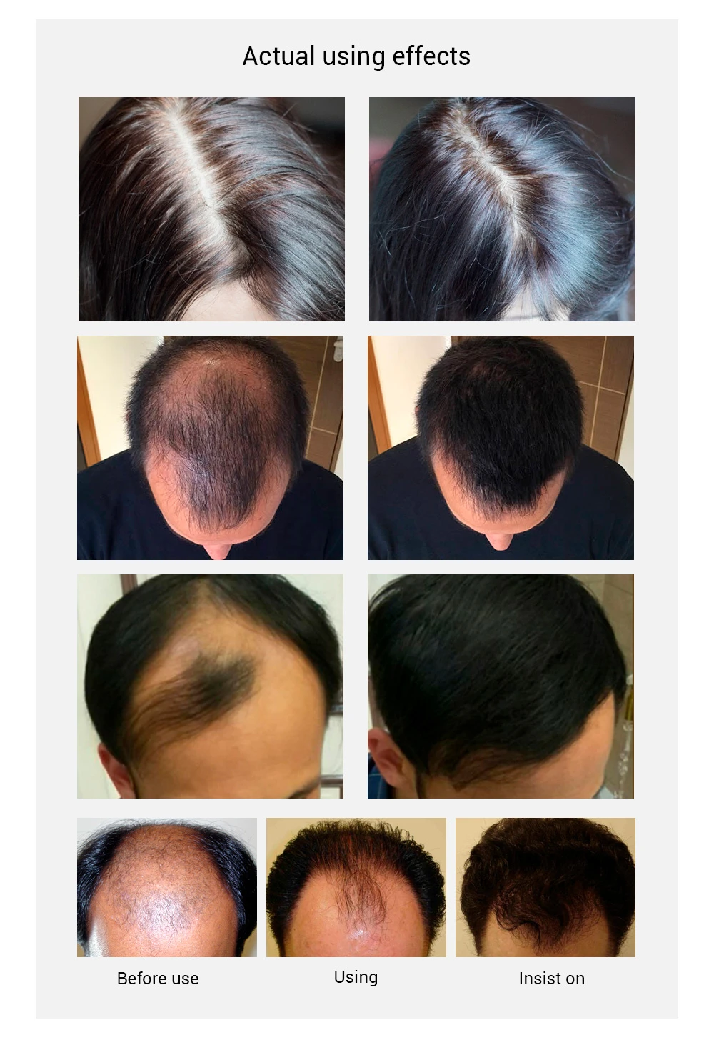 Loss Products Protective Grow Redensyl Rapid Grease Mink Wholesale Prunus Amygdalus Proven Promed Hair Growth Serum