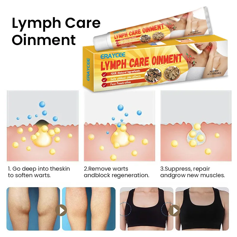 Herbal Lymphatic Drainage Cream Anti-Swelling Lymph Node Treatment Breast Ointment Lymphatic Ointment