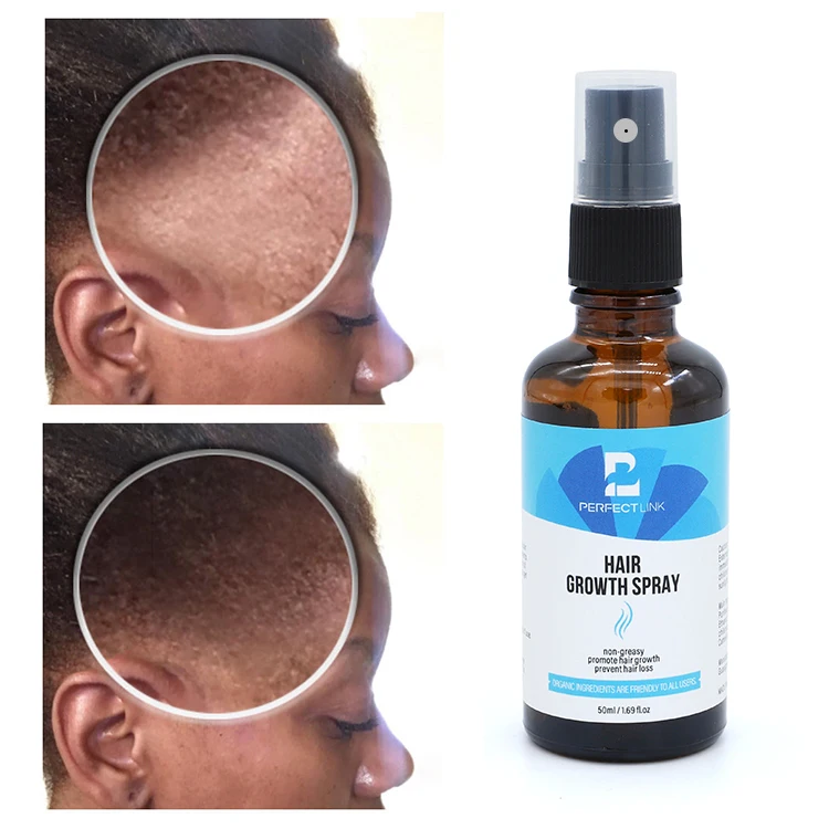 OEM Free Sample Strengthen Hair Follicles New Men Hair Grow Spray Herbal Extract Hair Growth Spray Effective 30ml