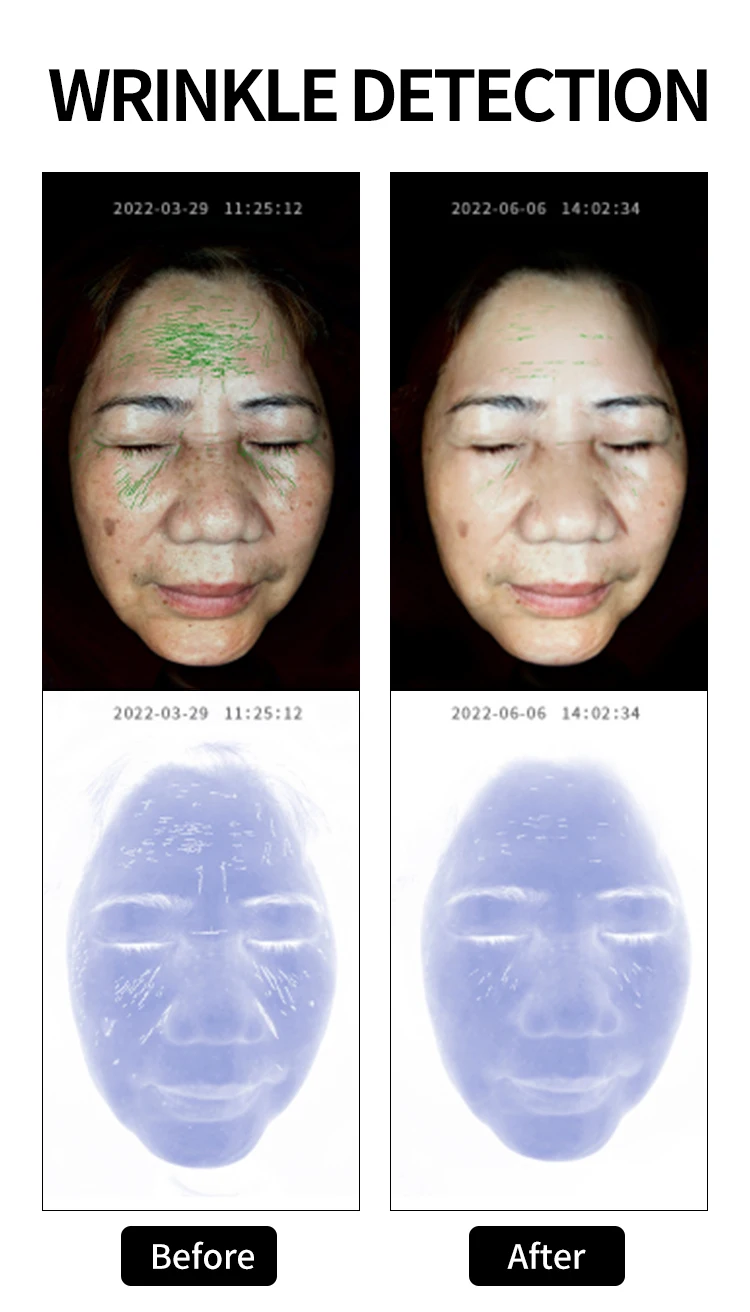 New digital skin scanner 3d face scanner digital skin analysis machine