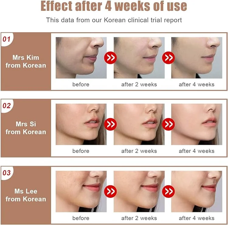 V-Face Massager 28.jpg