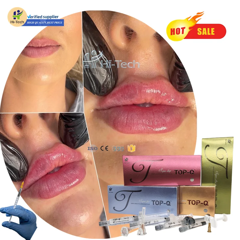 manufacturer wholesale Derm 1ml 2ml body lips filling beauty wrinkle acido hyaluroinic acid dermal filler