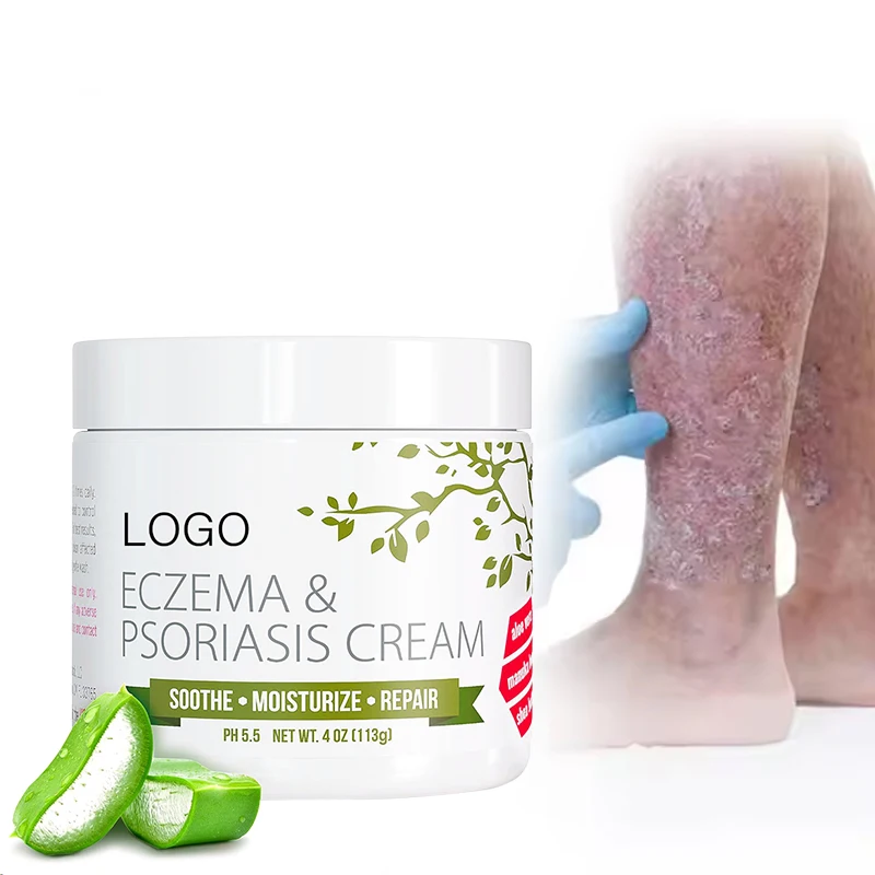 OEM/ODM Eczema Urticaria Alergy Skin Ointment Natural Herbal Skin Itching Care Cream Dermatitis Eczema Ointment relief balm