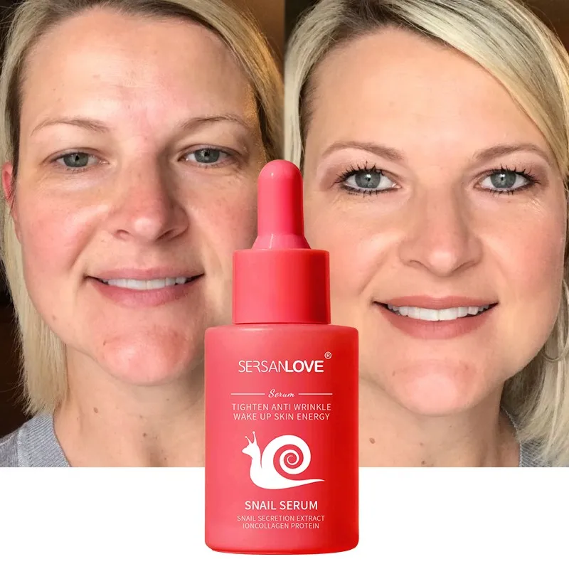 Private Label Natural Organic Anti-aging Lightening Whitening Skin Care snail mucin serum private label