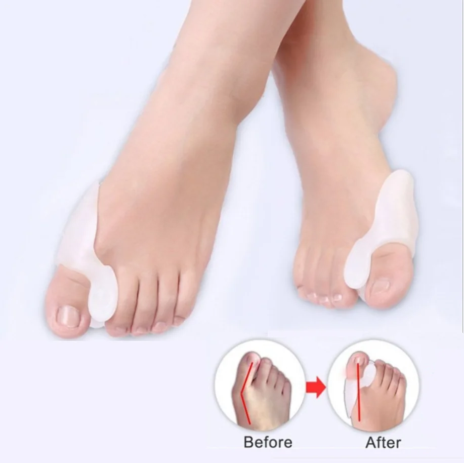 Single Toe Hallux valgus separator Medical Silicone SEBS Gel and big Thumb orthosis Small Portable Foot Orthosis