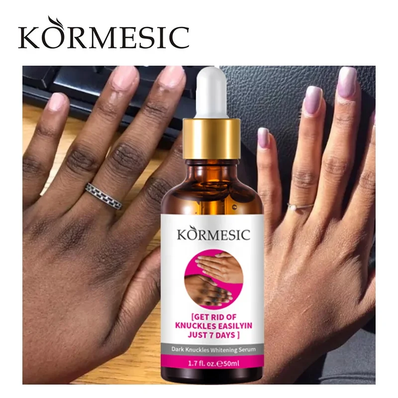OEM KORMESIC частная торговая марка сыворотка для быстрого отбеливания темных суставов рук локтей коленей удаления интенсивных пятен