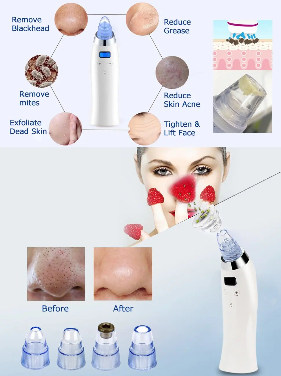 beauty device Acne removal kit electric facial blackhead remover pore deep cleaner Blackhead Vacuum suction