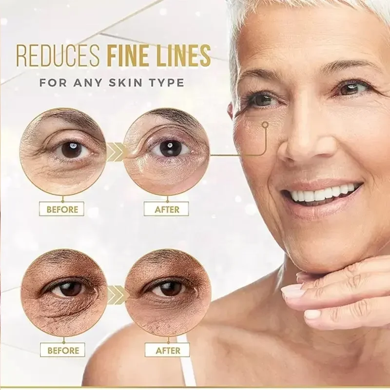 Moisturizing hyaluronic acid cooling eye mask dark circles eye bags removal gold eye patches gel pad