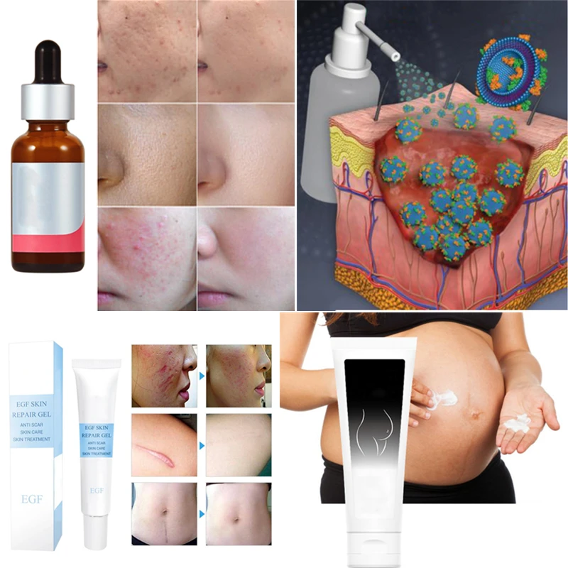 Hearan Cosmetic Grade Human Peptide EGF Powder Epidermal Growth Factor Oligopeptide-1 for Serum Cream Mask