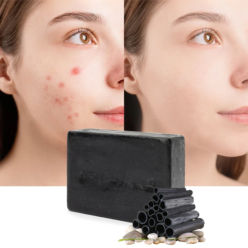 High Quality Anti Acne Whitening Skin Lightening Basic Cleaning Organic Bamboo Charcoal Soap African Black Soap