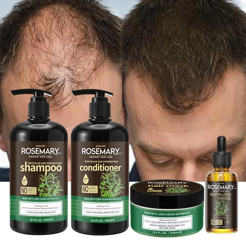 OCCA Natural Custom Private Label Anti Loss Hair Growth Oil Products Biotin Organic Rosemary Mint Hair Shampoo And Conditioner