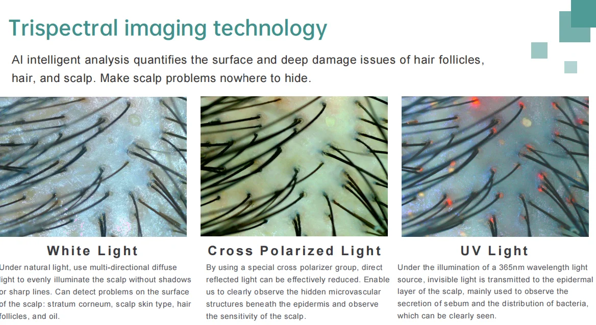 Professional Scalp Management Machine Hair And Scalp Analysis Machine Ai Scalp Analyzer