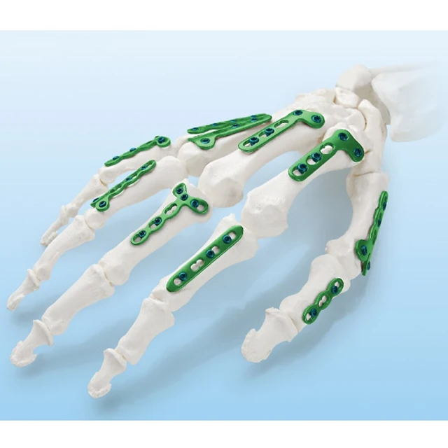 Wall Mounted Surgical Led Medical Operating Light Ceiling-mounted Shadowless Led Operating Lamp Examination Light