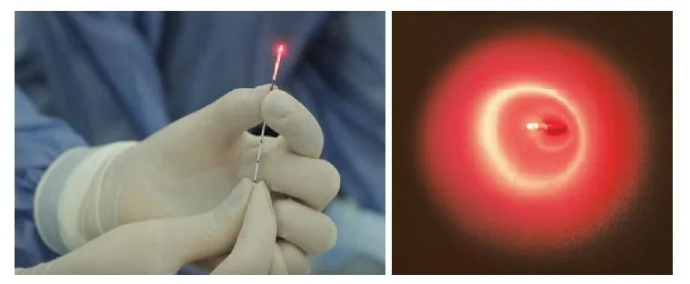 980nm 15watt  Lightweight Hemorrhoid Treatment Laser Proctology surgery diode laser machine